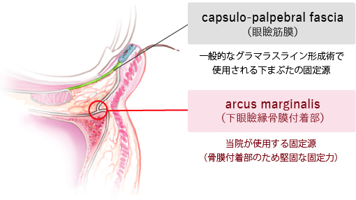 arcus marginalis(下眼瞼縁骨膜付着部)