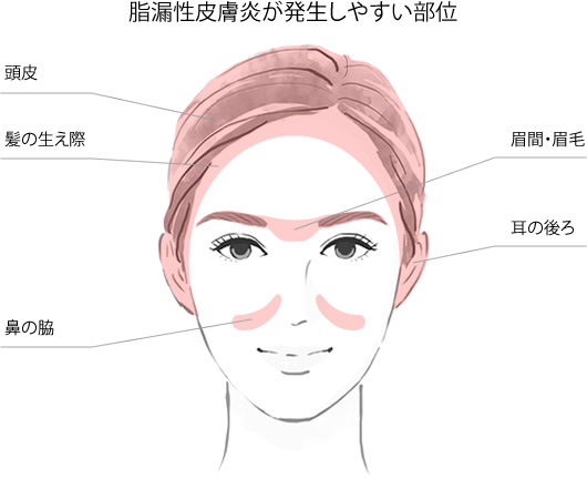 脂肪注入が可能な部位