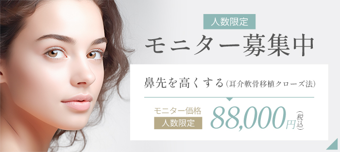 人数限定モニター募集中