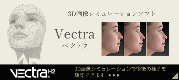 3D画像シミュレーションソフト ベクトラ
