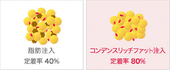 80%以上の高い生着率を実現
