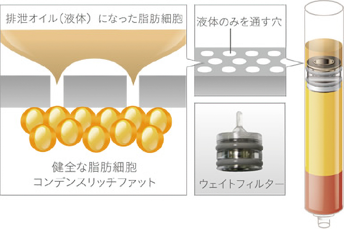 分離法