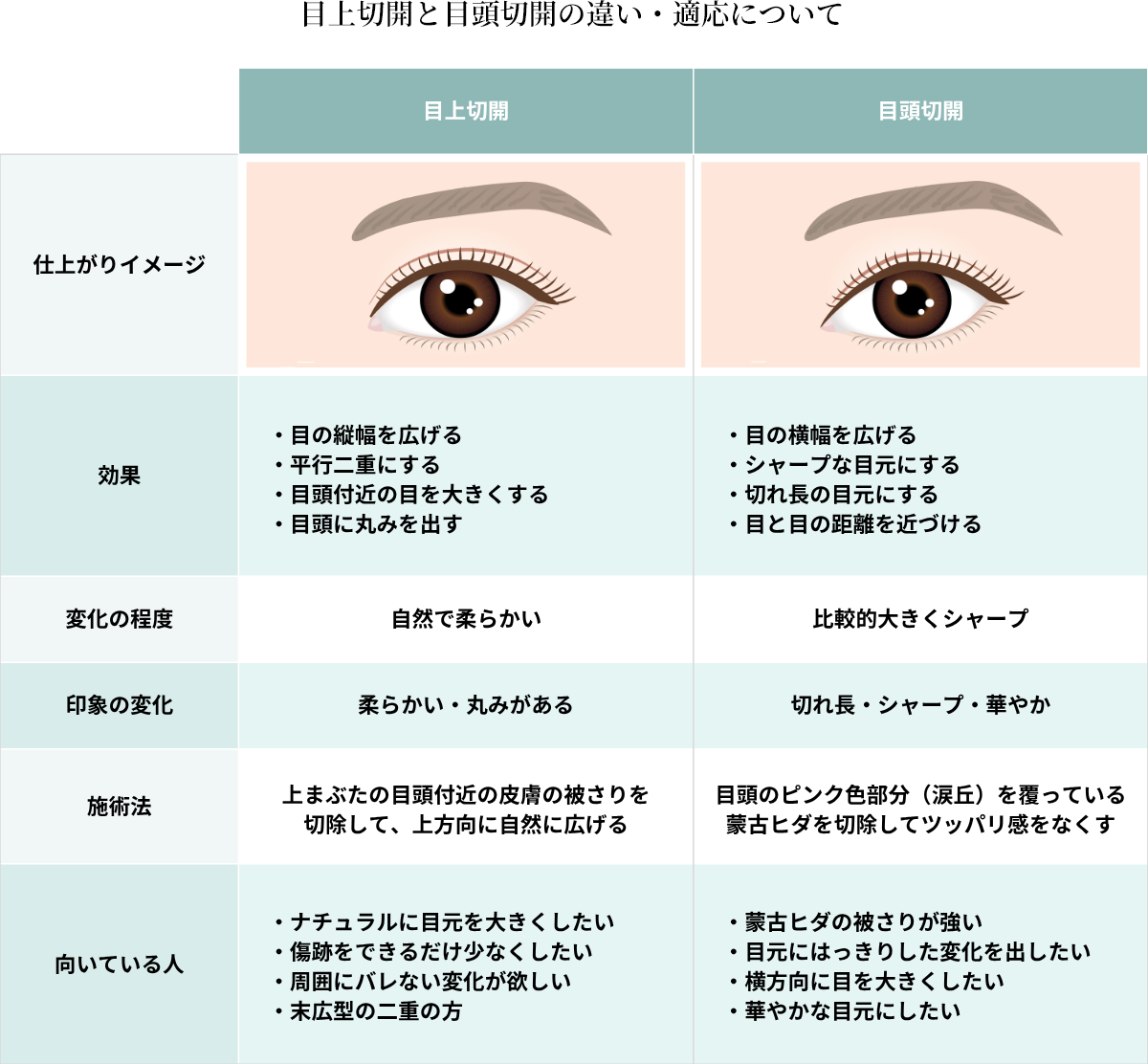 目上切開と目頭切開の違い・適応について