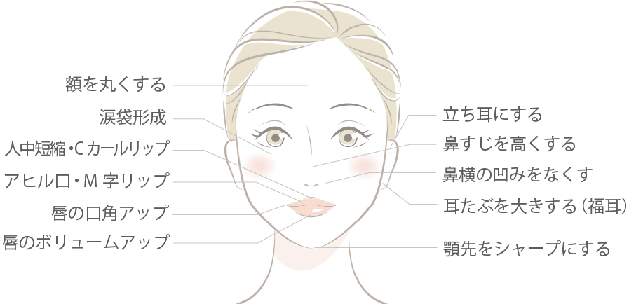 プチ整形(ライン形成)として