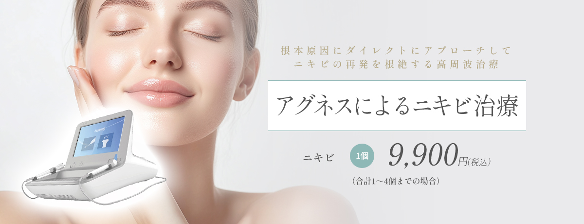 アグネス(高周波)によるニキビ治療