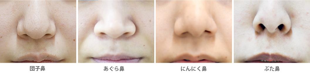 幅広い鼻のお悩みに対応。【50種類以上】の施術法をご用意しています