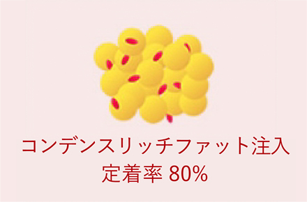 コンデンスリッチ脂肪注入