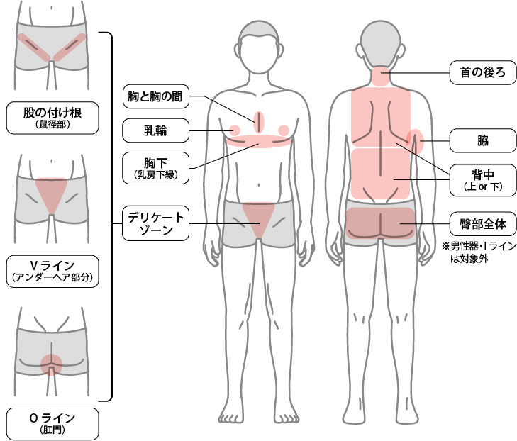 ミラドライ治療が可能な部位