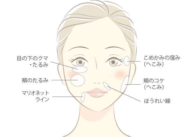 アンチエイジング