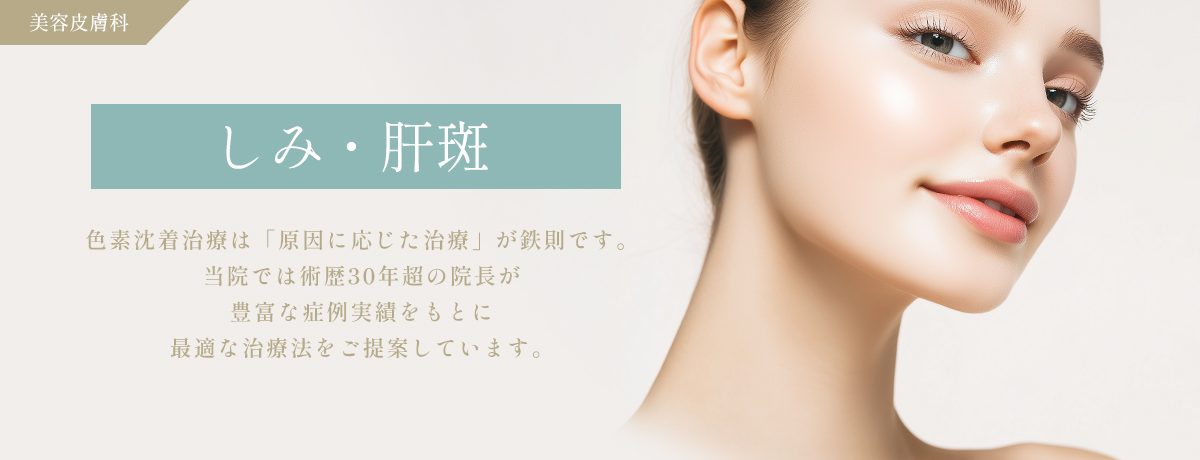 しみ・肝斑