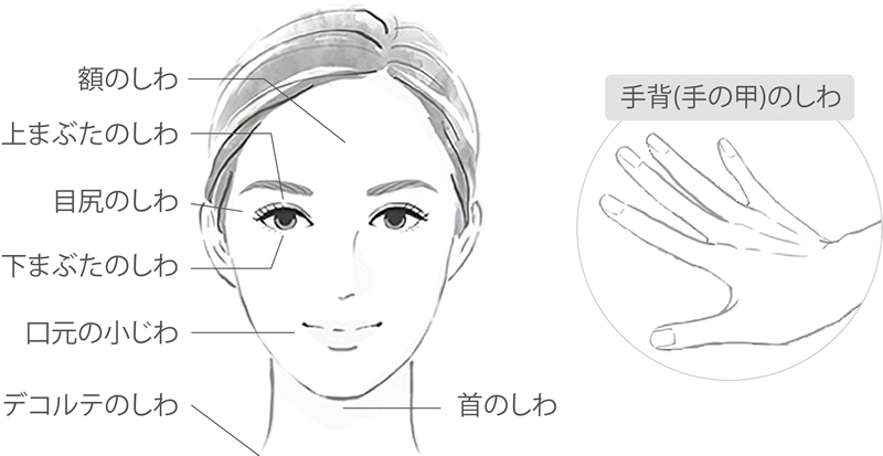スネコス注射で改善できるしわ