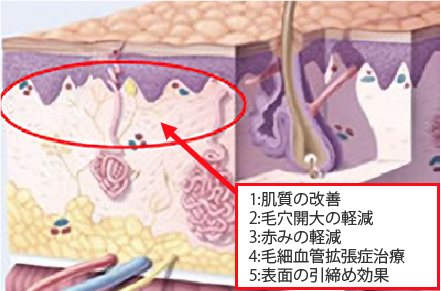 エクセルV(ヴイ)について